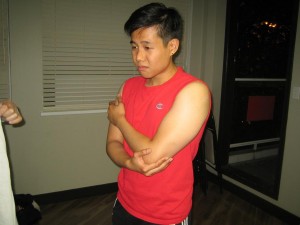 Arm and elbow pain
